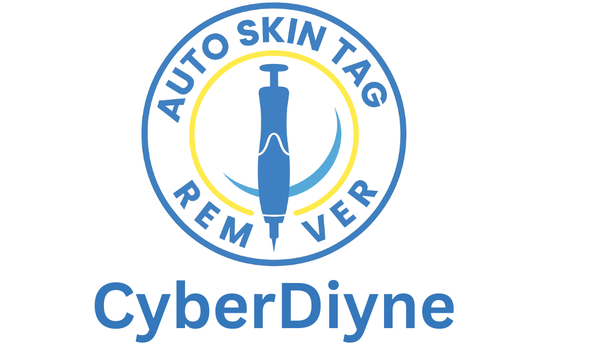 CyberDiyne